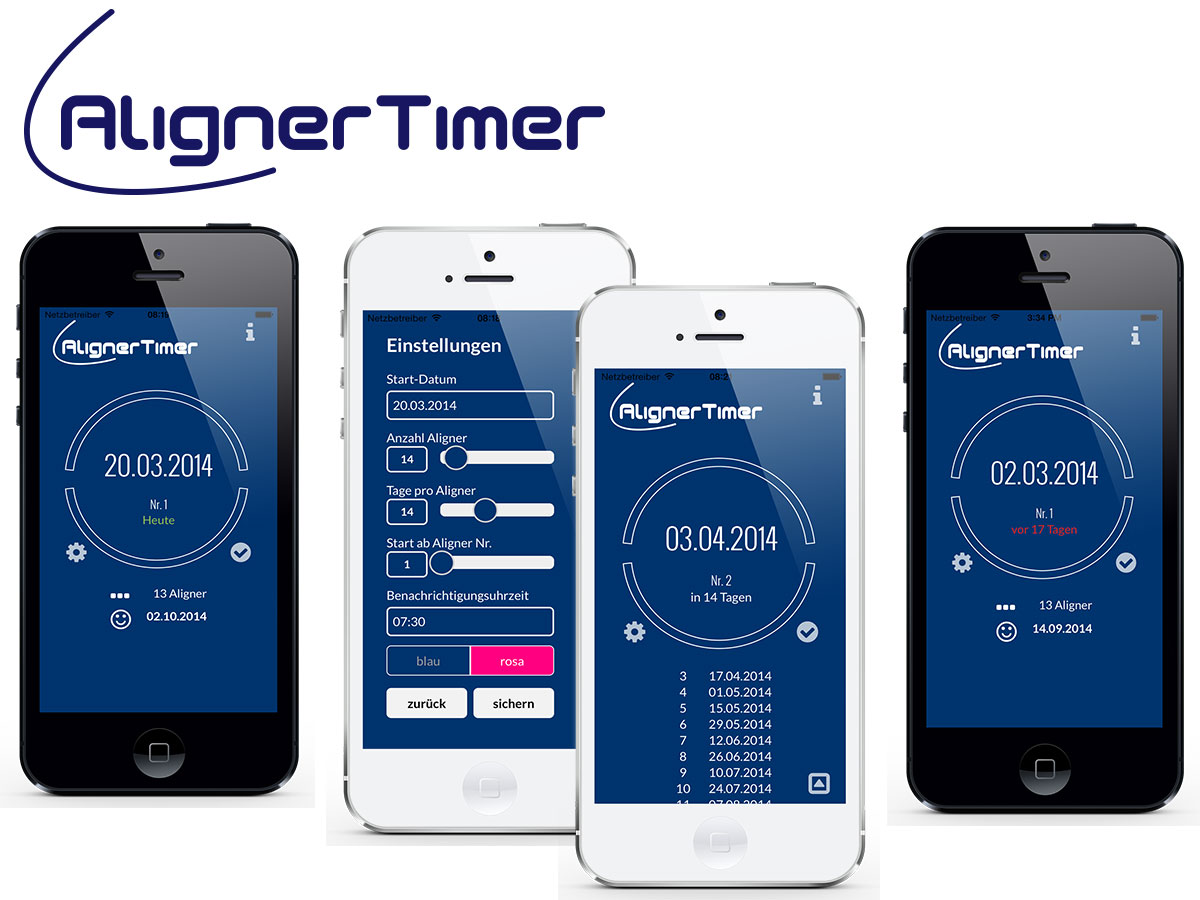 Aligner Timer